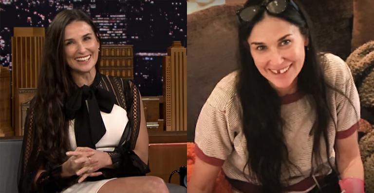 Estresse pode causar perda de dentes? Entenda o caso de Demi Moore